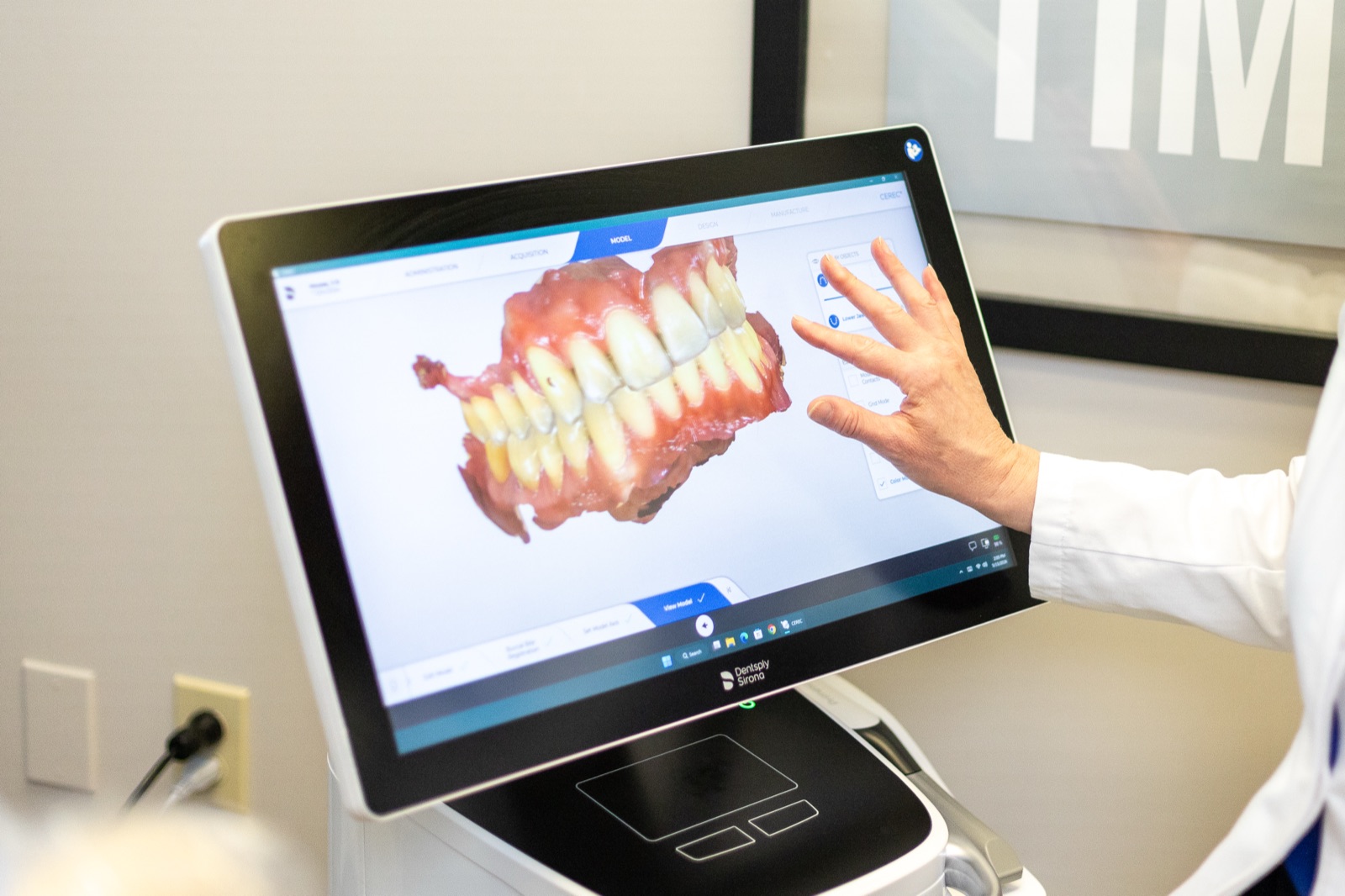 A 3D dental scan displayed on the operatory monitor for implant planning