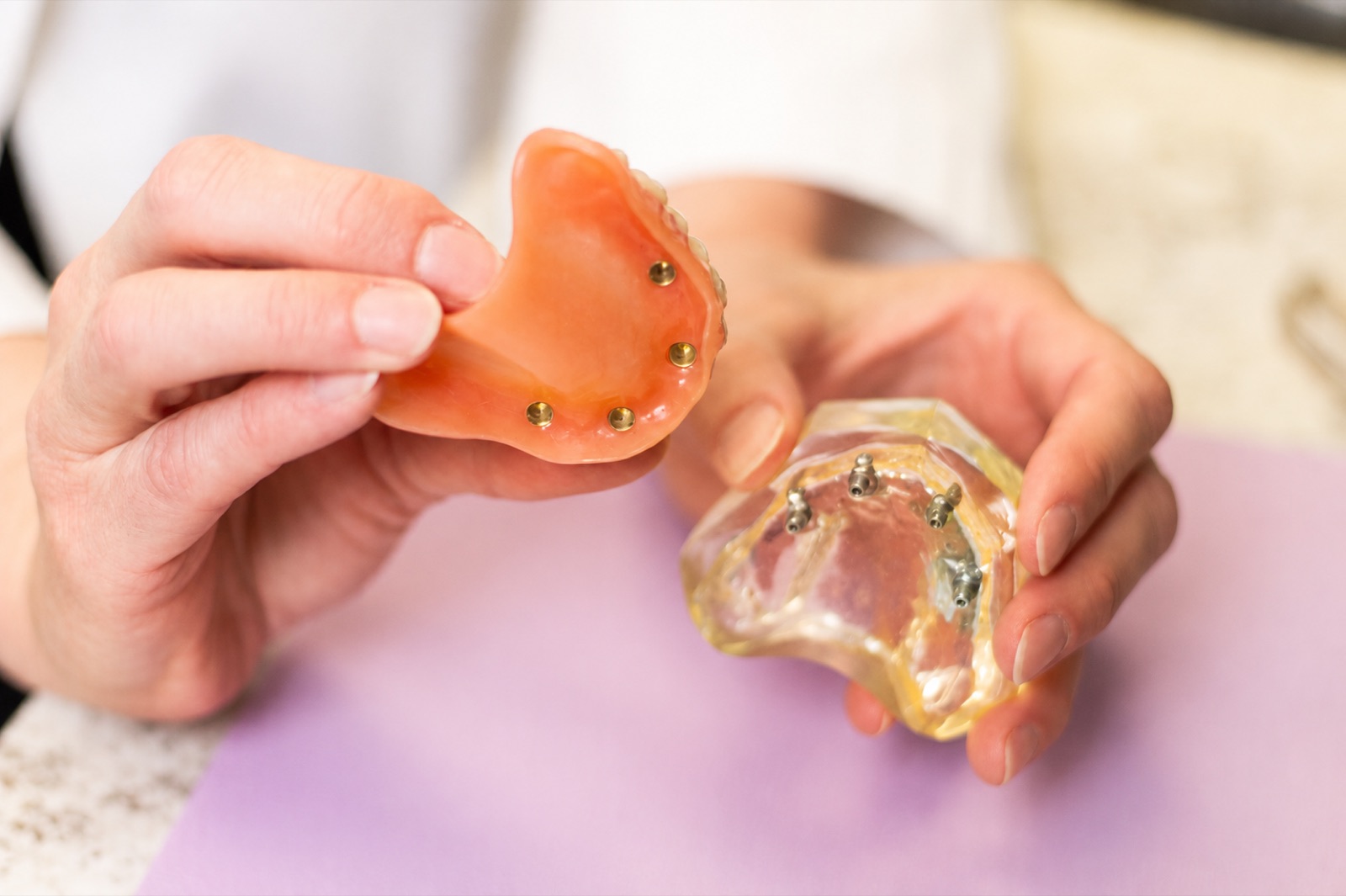 A locator denture shown separated from its implant attachment bar